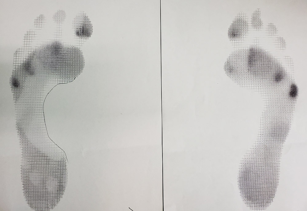 foot scan